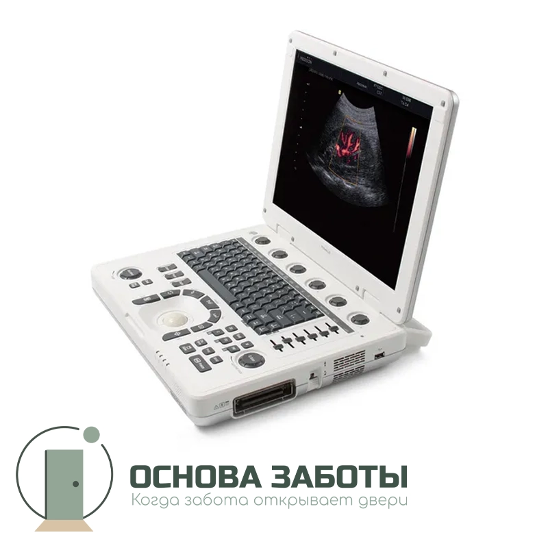 Аппарат УЗИ MySono U5 от Samsung Medison