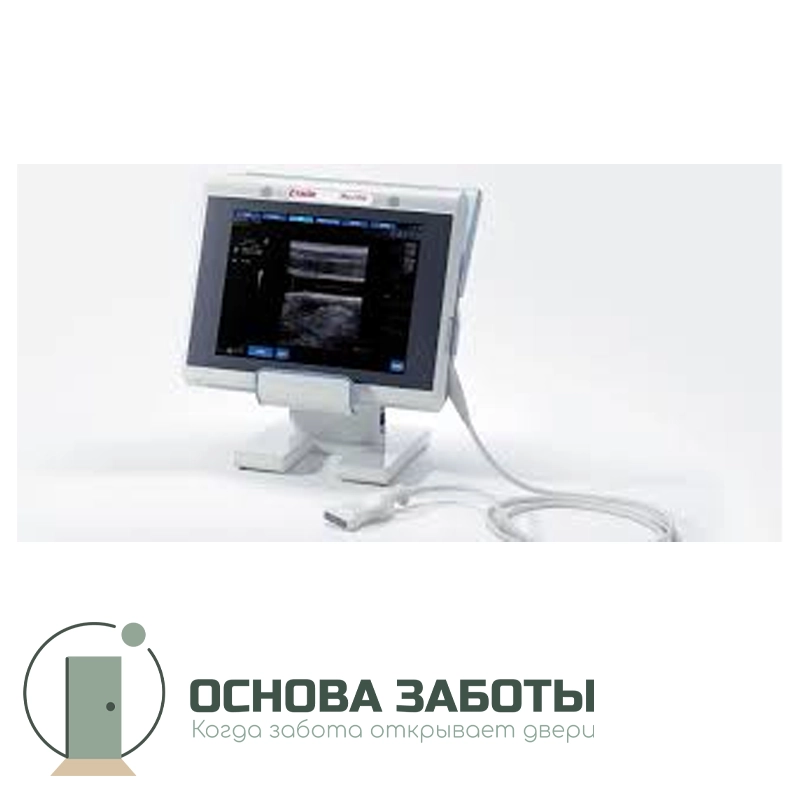 УЗИ аппарат MyLab One от Esaote